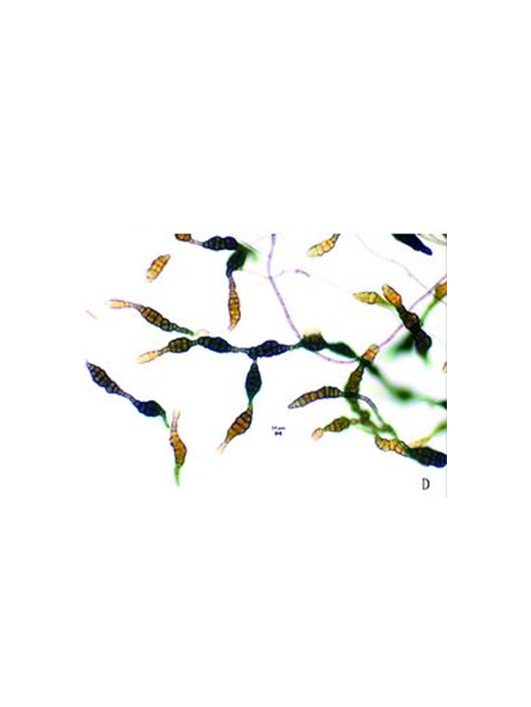 蠟蚧輪枝孢菌