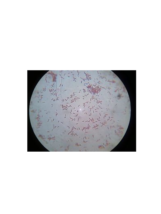 蠟樣芽孢桿菌